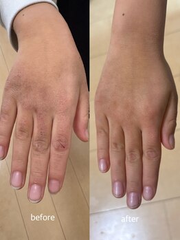 オニュ(onyu)/劇的変化！P-UPジェル