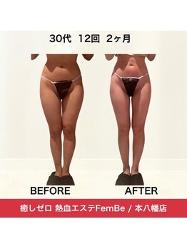フェムビー(FEMBE)/1番人気！２ヶ月集中コース！