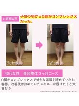 えのもと美容整体院/【美脚・O脚改善】