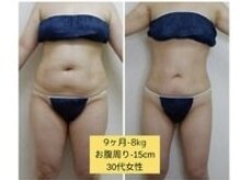 アムール 麻布十番(Amour)の雰囲気（最新エンダモロジーアライアンスで最短痩せ！短期間お得コース）