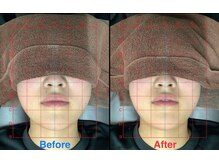 ビタミンスパ 中野店/小顔矯正★初回体験