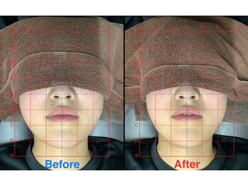 ビタミンスパ 中野店/小顔矯正★初回体験