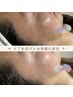 艶肌【ララピール】(首・頭皮まで施術)LED美顔器・デコルテマッサージ付き