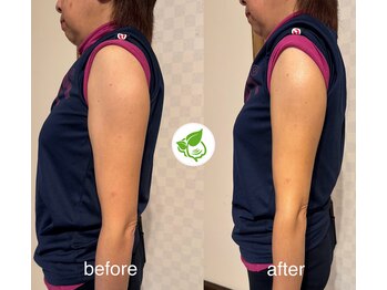 カイロプラクティック ネクサス/背中の疲れと腕のむくみ撃退◇