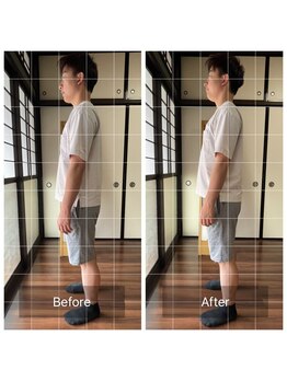 ミントのかべの整体院/ビフォーアフター