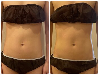 サロンドフェイス(Salon de Faith)/【リリースカッター】1回施術♪