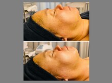 モンセルヴィ(monselvi)の雰囲気（フェイシャルメニュー豊富！リフトアップ/むくみ改善/毛穴悩みも）