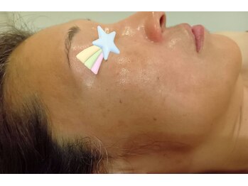 麻謝/【使用後】Dr.PUR BEAUTE化粧品