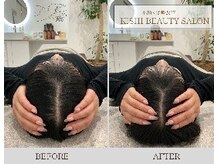 小顔×姿勢改善 KISHI BEAUTY SALON/【小顔矯正】
