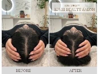 小顔×姿勢改善 KISHI BEAUTY SALON/【小顔矯正】