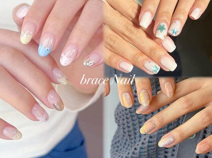 ブレスネイル(brace Nail)の写真