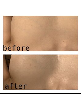 エマーチェ 自由が丘(emmace)/自由が丘希少なバストプログラム