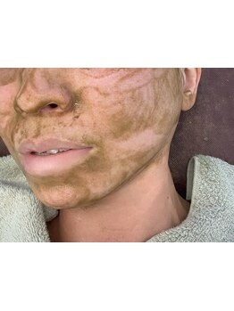 毛穴ケアをしたい