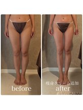 ブリス(BLiSS)/このみ式リンパ