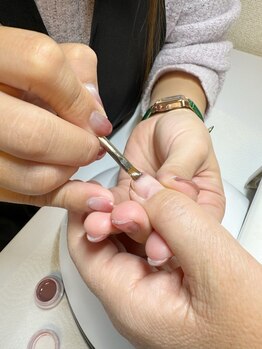 爪の悩みを解消できる（ケア含む）