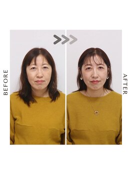 シュアリー(Surely)/トータルコースお客様事例