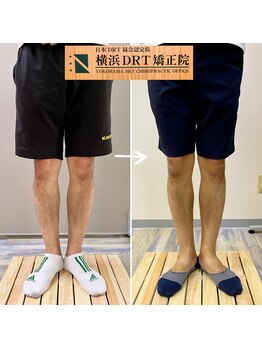横浜DRT矯正院/O脚矯正