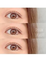 エン(EN.)/目元に影がなくなり明るい印象へ