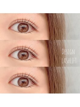 エン(EN.)/目元に影がなくなり明るい印象へ