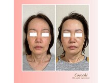 ココ(COCO.)の雰囲気（1度での変化はできませんが本気でお悩みの方をサポートします！）