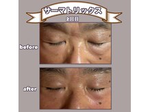 ビーマジック(美magic)の雰囲気（#サーマトリックス 2回の変化）