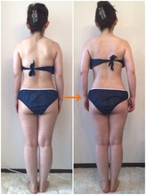 ビューティー サロン ハナ(Beauty Salon hana)/猫背改善☆施術4回