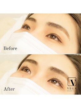 ヴィーガ(VEGA)/ご紹介割引両者20%オフ