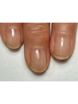 爪の悩みを解消できる（ケア含む）