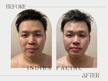 パリワール(pariwar)/インディバ＊ビフォーアフター