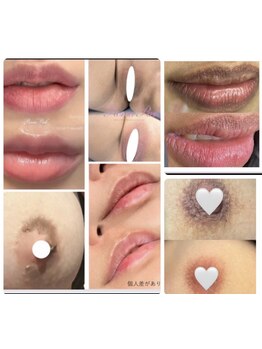 お肌をきれいにしたい