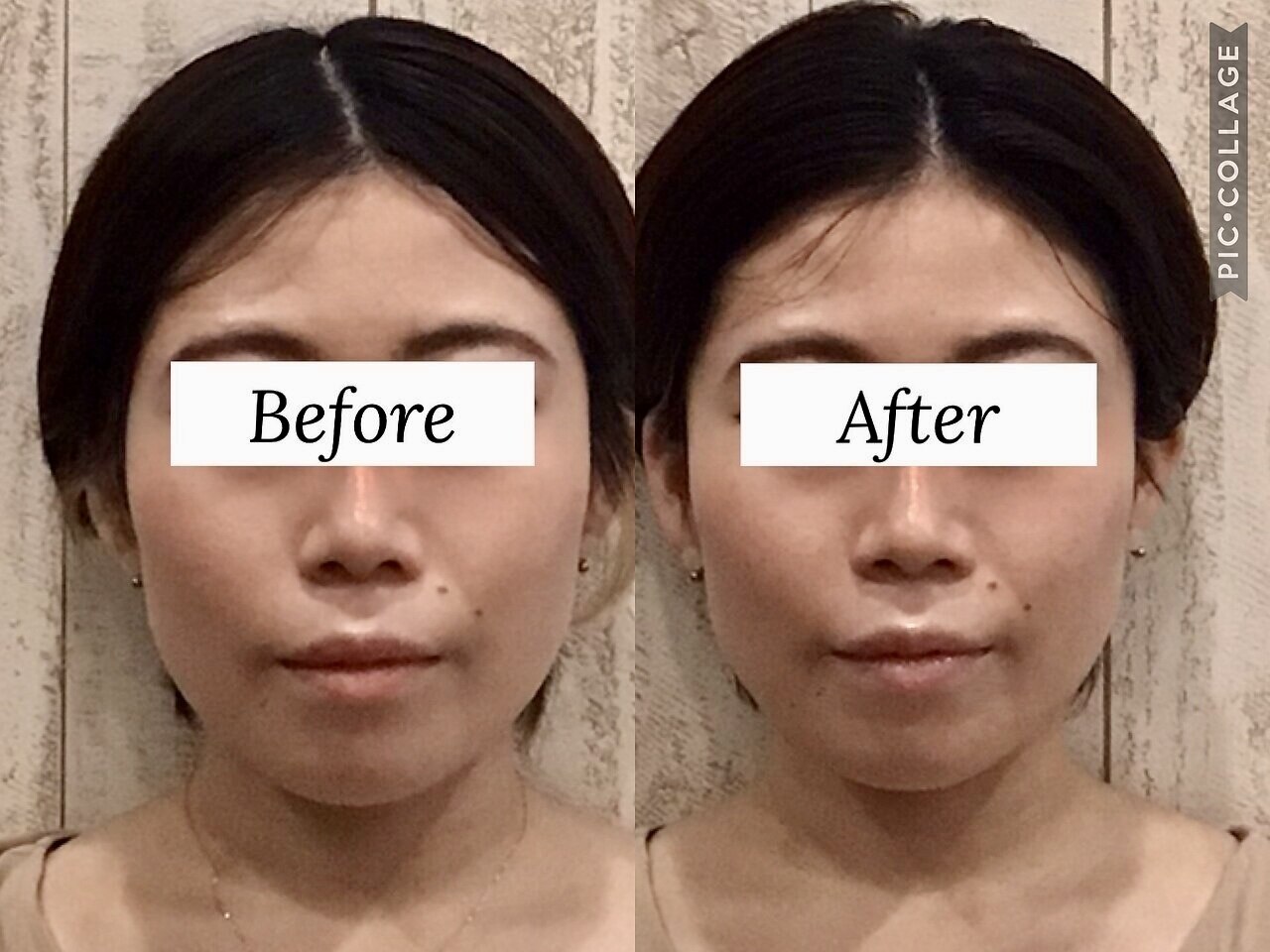 フォト｜スピード小顔 渋谷店 (Speed)｜ホットペッパービューティー