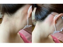 ティンク(Tink)/うなじワックス☆Before→After