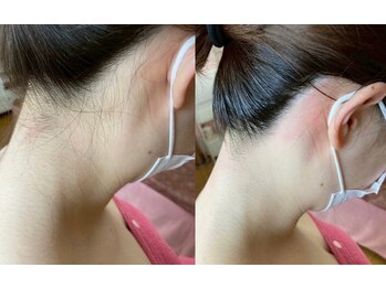 ティンク(Tink)/うなじワックス☆Before→After