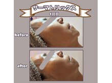 ビーマジック(美magic)の雰囲気（#サーマトリックス でハリとリフトアップで若々しく）