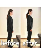 整体コンディショニング セレクト/猫背・首肩こりが悩みで来店