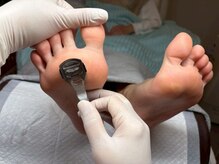 ドクターネイル爪革命 岐阜店/たこケア