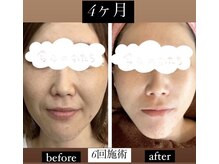 チャルム(CAL'ME)の雰囲気(大人のためのトータルエステサロン・最新のマシンや施術が充実!)