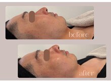 ステラ(STELLA)/男性もご予約可能◎