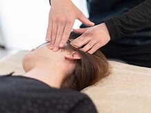 リリース(Release)の雰囲気（Release式小顔矯正はエラ張りや顔の歪みなどのお悩みの方に◯）