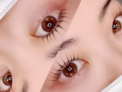 リトマス(LITMUS)の写真