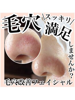 ルネッタ(Lunetta)/