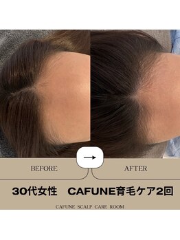 カフネスカルプケアルーム(CAFUNE SCALP CARE ROOM)/