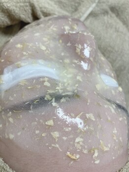 フェアリーヘア ニーナ(Fairy Hair Ni-na)/日焼け後のアフターケア