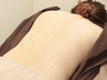 鍼灸院 虹/鍼灸　美容鍼