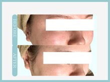 アコガレコガオ 八戸店/