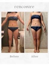 ランコント(rencontre)/肩こり/リンパ/ヘッドスパ/痩身