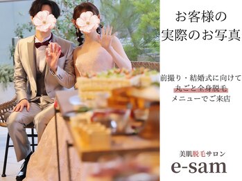 イーサム(e-sam)/丸ごと全身脱毛