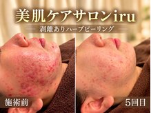アイル 代々木上原店(iru)