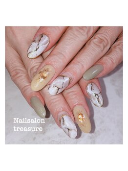 トレジャー(treasure)/