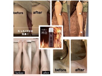 エマーチェ 自由が丘(emmace)/マックスボディオプション